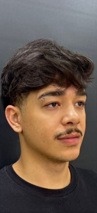 Antes: harmonização facial masculina